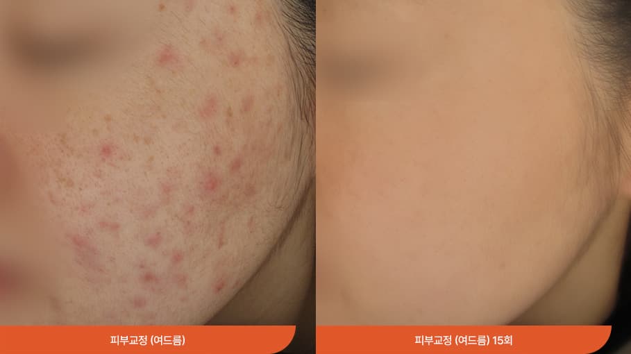 敏感性皮肤治疗